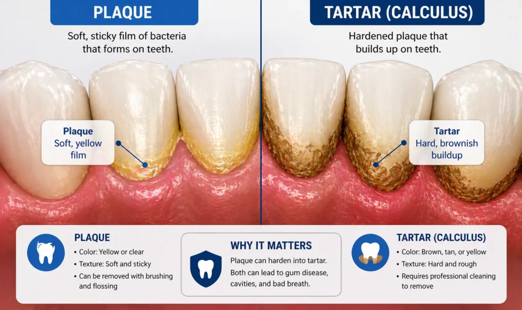 Difference between plaque and tartar on teeth visual guide